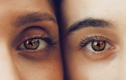 eye skincare