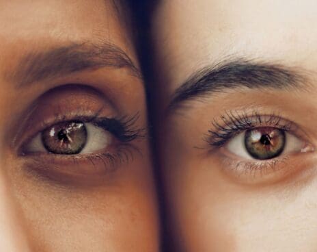 eye skincare