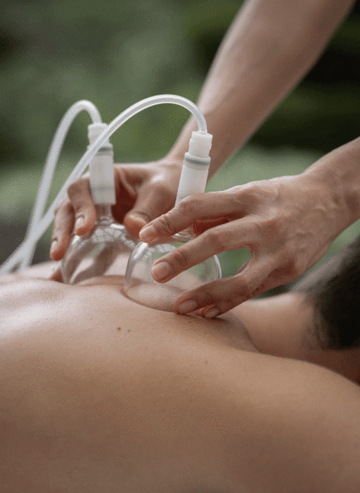 cupping massage